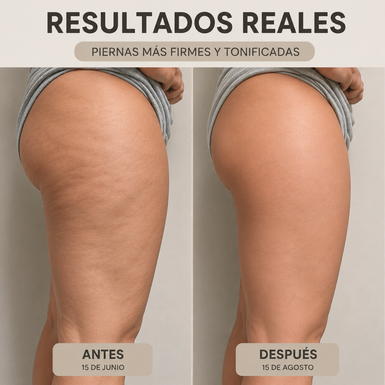 CelluFit™ – Shorts 3D Anticelulíticos y Moldeadores